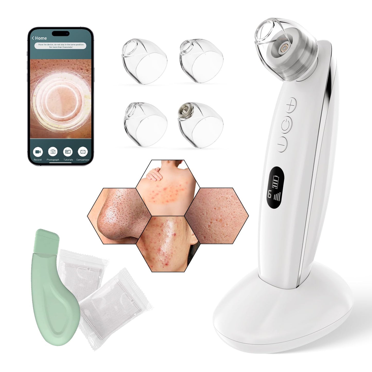 Blackhead Remover Vacuum Pore Extractor for Face with Camera & Scraper Facial Cleanser Pore Vacuum Tools Kit for Men Women USB Wireless Charging 4 Suction Heads, 6 Adjustable Modes (White)