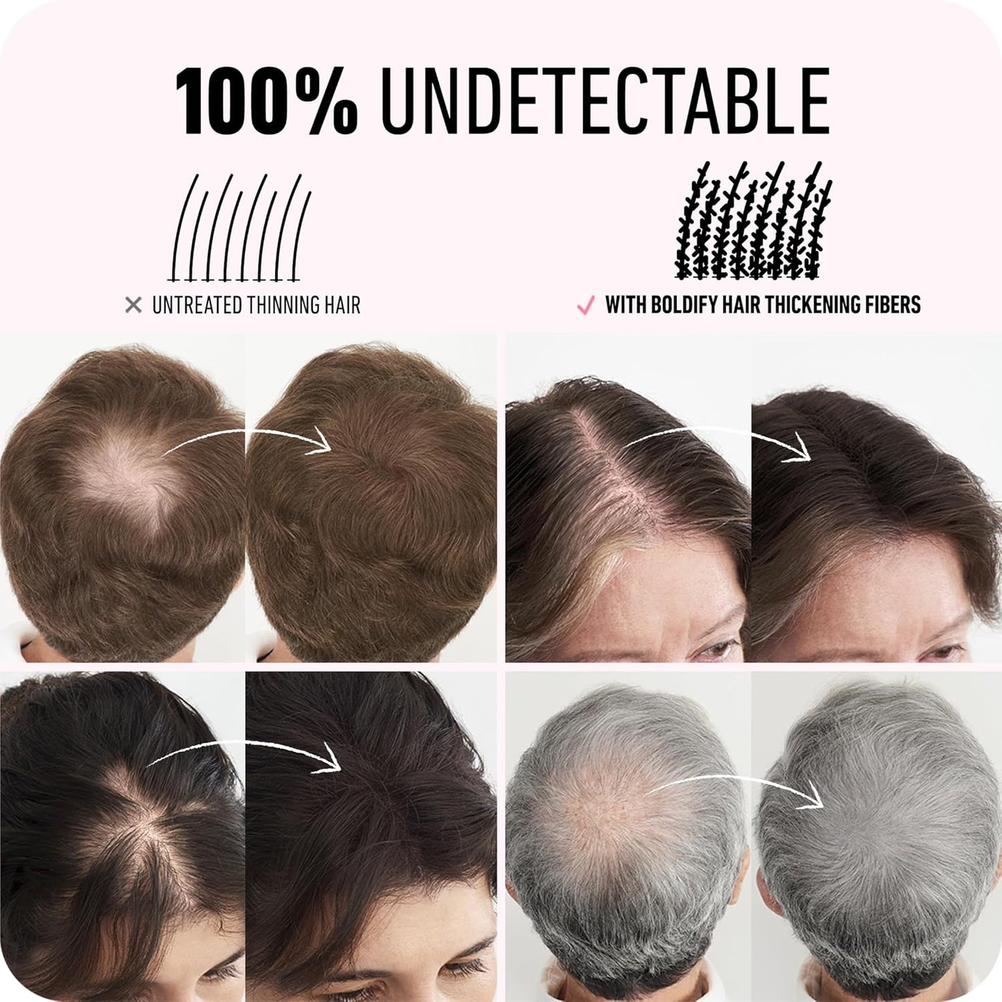BOLDIFY Hair Fibers (28g) - Fill In Thinning and Fine Hair for an Instantly Fuller, Thicker Look - 14 Shades for Women & Men - Dark Gray