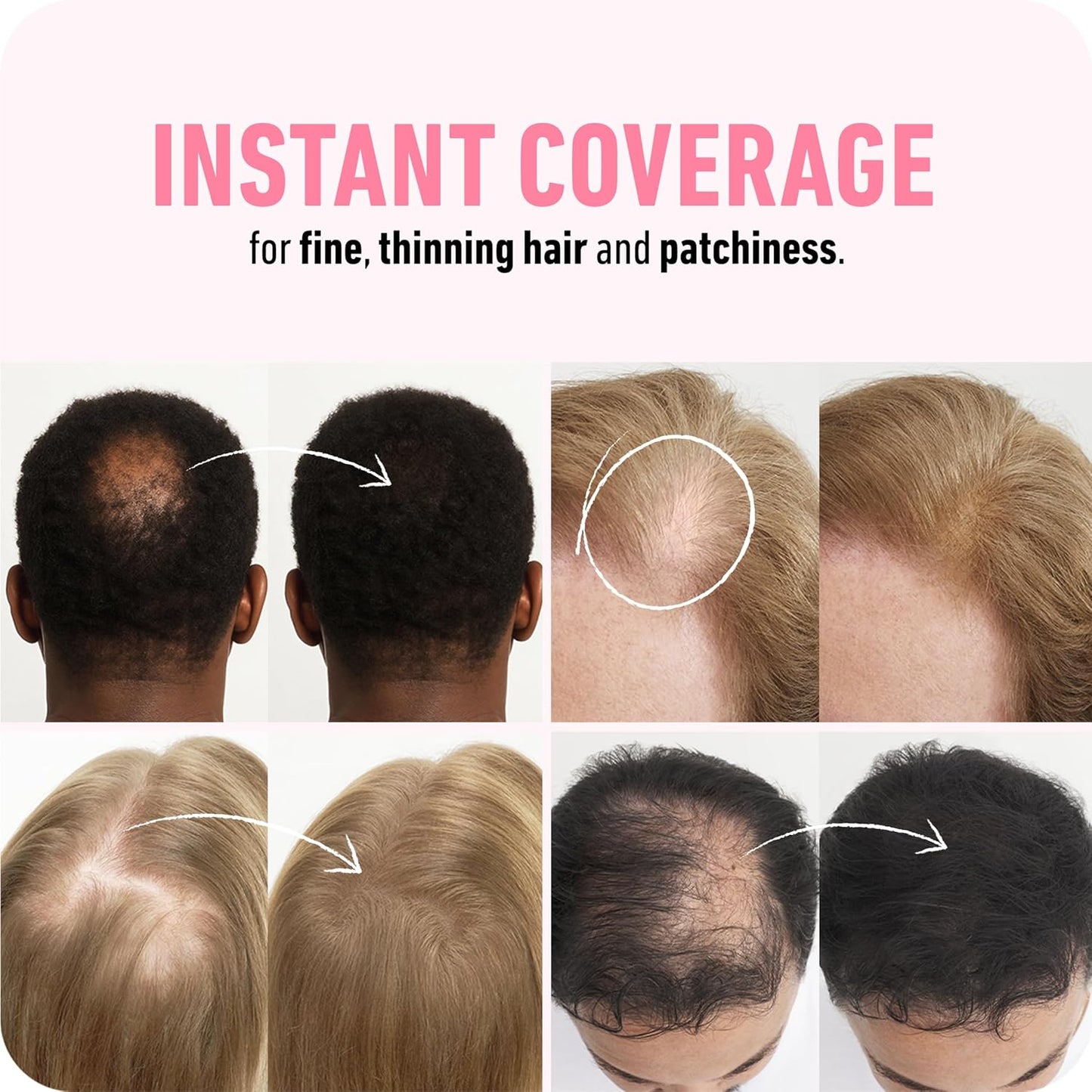 BOLDIFY Hair Fibers (28g) - Fill In Thinning and Fine Hair for an Instantly Fuller, Thicker Look - 14 Shades for Women & Men - Medium Blonde