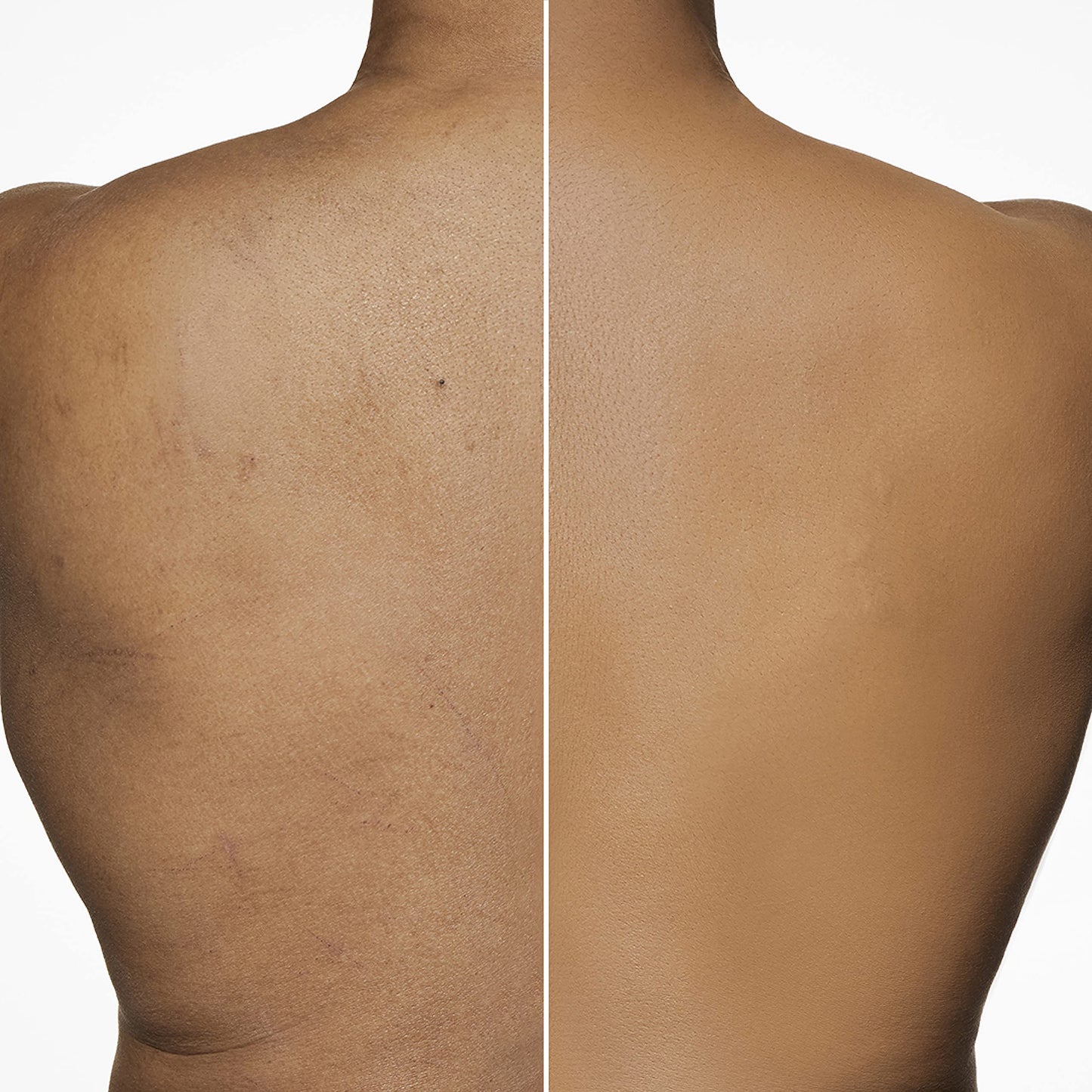 Dermablend Leg and Body Makeup Foundation with SPF 25, 45W Tan Honey, 3.4 Fl. Oz.